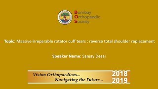 Massive irreparable rotator cuff tears : reverse total shoulder replacement By Dr. Sanjay Desai