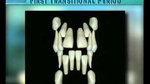 Clip 15: Transition of Mandibular and Maxillary Incisors with Moderate Space