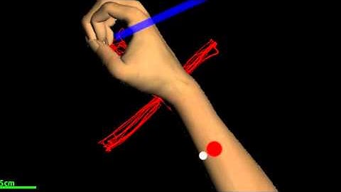 VGR inverted orientation