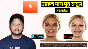 Airbrush: Easy Photo editor ।। Remove pimples Acne  ।। How to use Airbrush app🔥