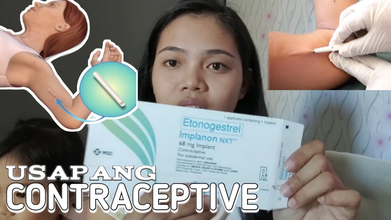 PARA DI AGAD MABUNTIS IMPLANT EXPERIENCE Family Planning Method My para-di-agad-mabuntis-implant-experience-family-planning-method-my