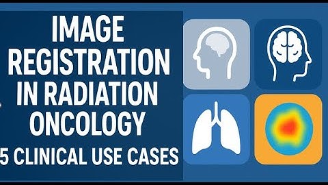 5 Use Cases of Image Registration in Radiation Therapy Workflow