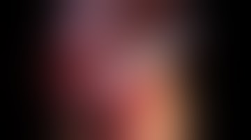 Difficult laparoscopic cholecystectomy in Plastered liver to Abdomen