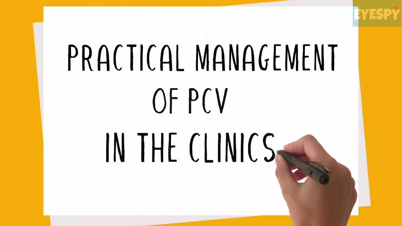 Practical Management of Polypoidal Choroidal Vasculopathy (PCV) in the Clinics
