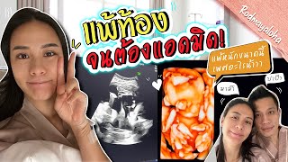 อัพเดทคุณแม่มือใหม่ ลูกชายหรือลูกสาวนะ[เลี้ยงง่ายๆ สไตล์รถเมล์]