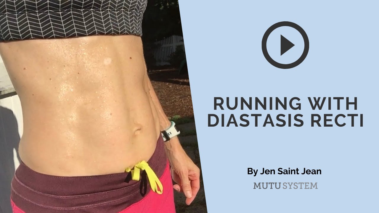 Diastasis Recti: Important Information You Need To Know — Running Wild