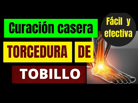 Video: Es bueno torcer