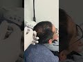 #dreamhairline #hairrestoration #hairtreatment #japanesepatient#prp#growthfactor#stemcell