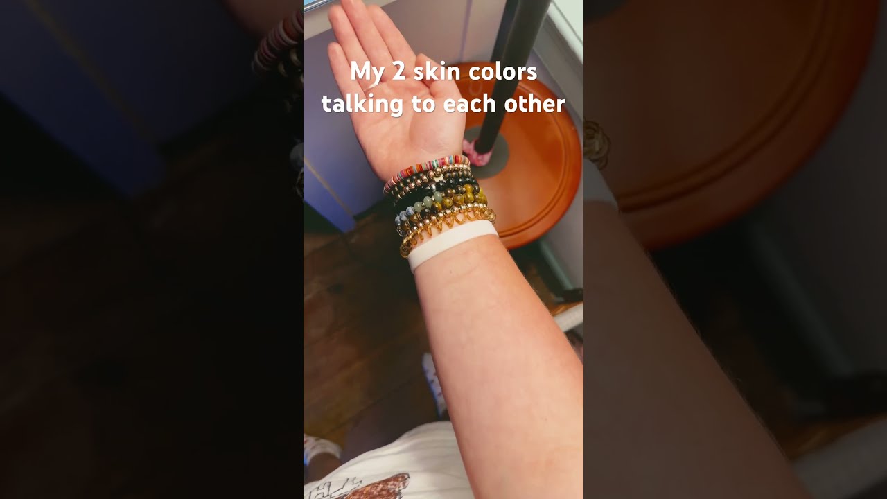 TW SH Scars Pls Don T Comment About Them This Silly Trend But I Just Get Really Tan Trending