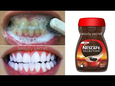 Teeth whitening in 1 minute/ removing the yellowness and tartar accumulated in the teeth,💯 effective