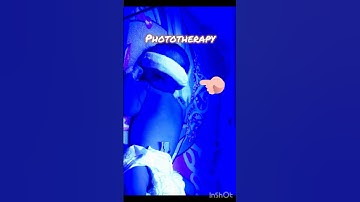 Phototherapy #jaundice in new born #trending #youtubeshorts #music #song