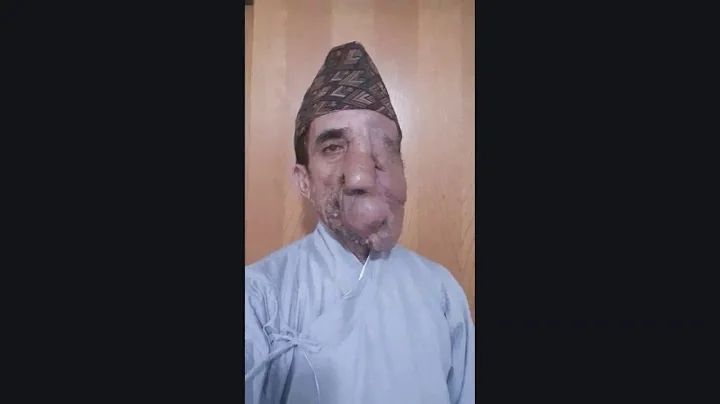 Ashok's Transformation