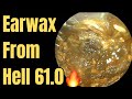 Earwax From Hell 61.0 🔥‼️