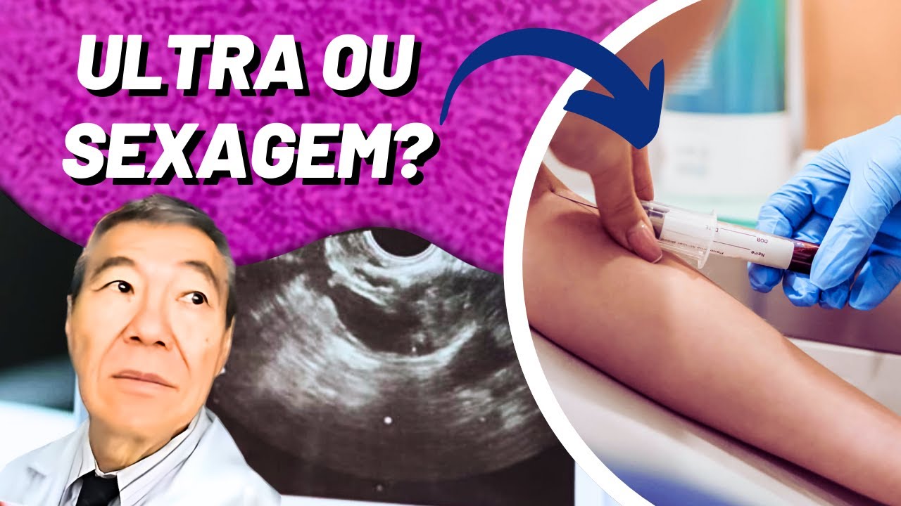 SEXAGEM FETAL X ULTRASSOM!