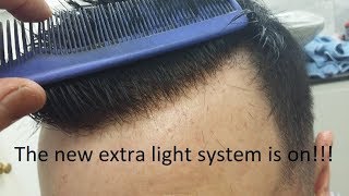 Hair Replacement System Fitting with new extra light hair density