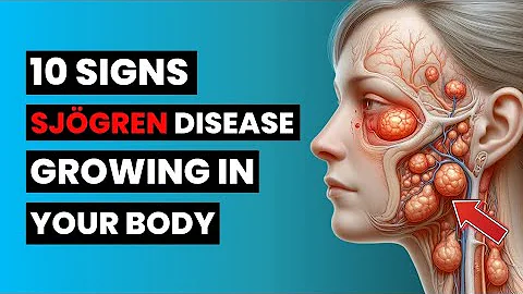 URGENT: The Sjögren's Symptoms You CANNOT Ignore (This Could Save Your Life!)