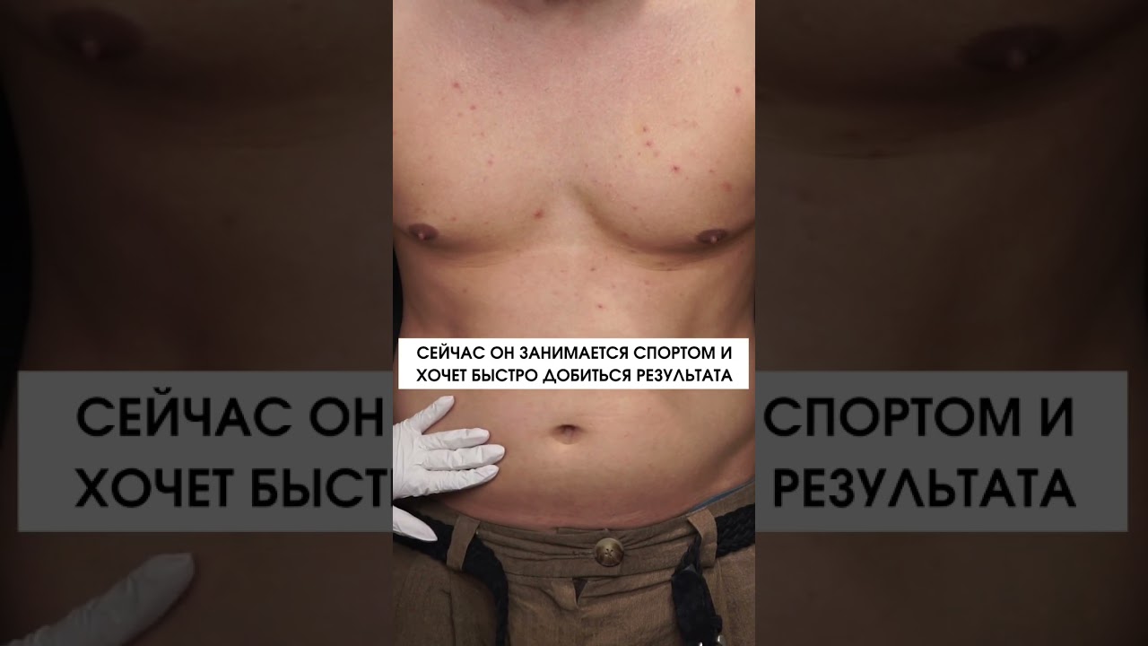 Избавляемся от жировых отложений