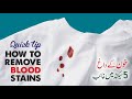 How to Remove Blood Stain | Quick Tip for Blood Spot by Tech Knowledge