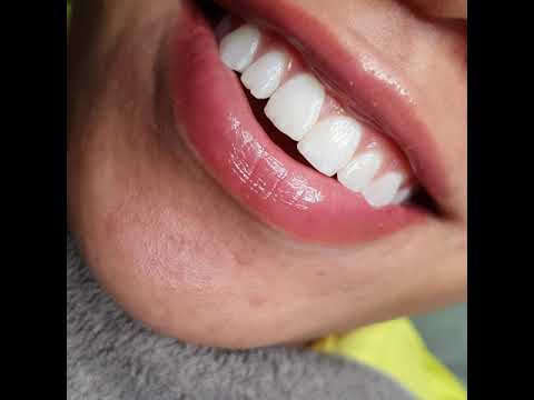 Aquarelle Lips |