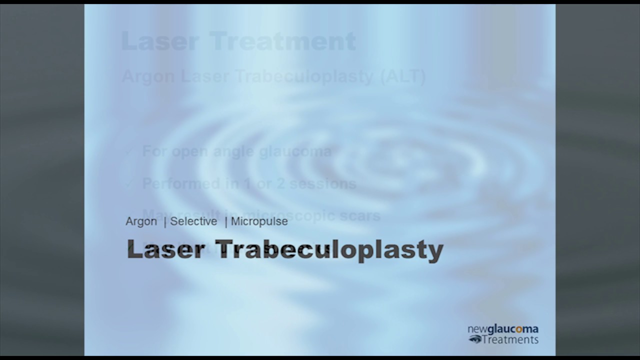 Laser Trabeculoplasty  for Glaucoma