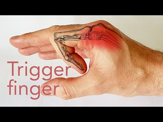 cum să îndrepți degetele după artrită crize și dureri în articulațiile umerilor și