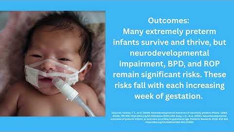 v15025gf0000d497oo7og65vnnot672g