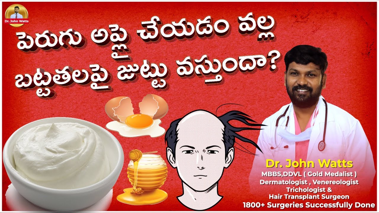 పెరుగు అప్లై చేయడం వల్ల బట్టతలపై జుట్టు వస్తుందా? | Benefits of CURD | Dr.John Watts