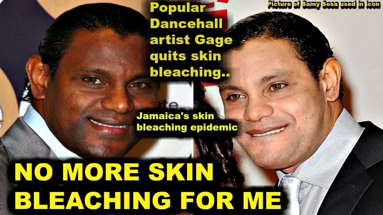 Skin Bleaching Epidemic In Jamaica Naturalskins