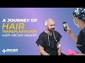 A Journey of Hair Transplant In Turkey with Mcan Health