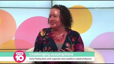 Carly Findlay: Changing The Conversation Around Disability | Studio 10