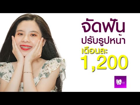 จัดฟันปรับรูปหน้า DENTE CLICINC ฟิวเจอร์พาร์ค รังสิต