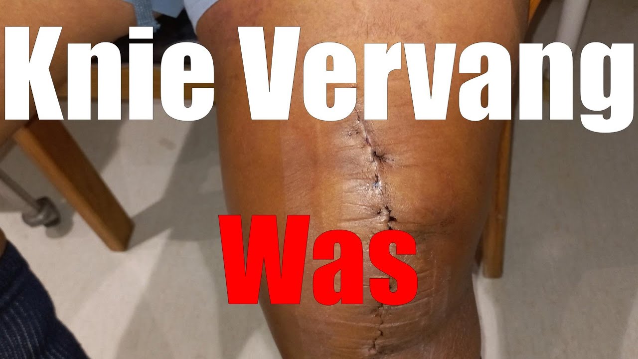 Totale knie vervanging Was na operasie YouTube