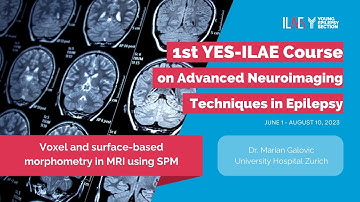 5th Lecture Voxel-Based Morphometry using Statistical Parametric Mapping