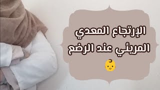 الإرتجاع المعدي المريئي عند الرضع: أنواعه و أعراضه، أسبابه، تشخيصه، الفئة الأكثر عرضة له و علاجه.