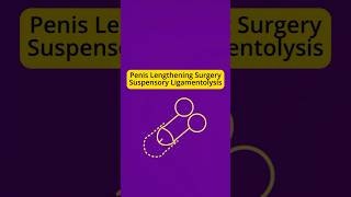 Penis Lengthening Surgery (Подовження статевого члену)