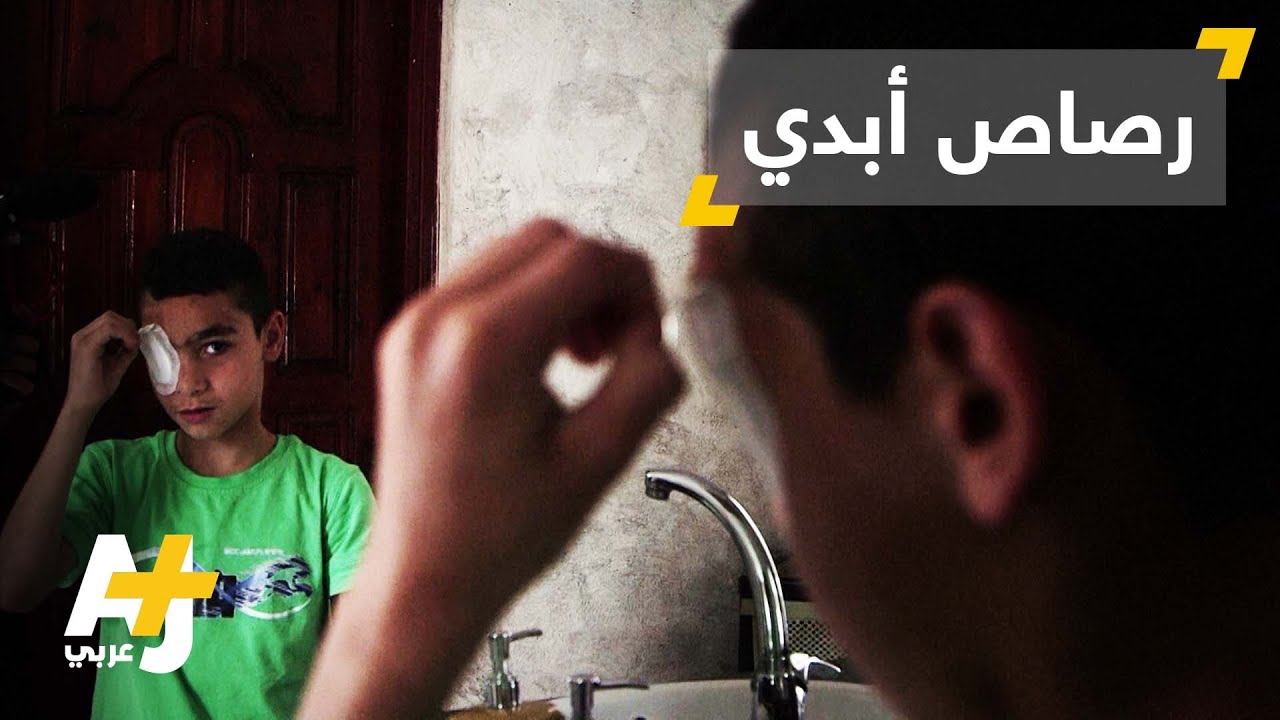 الفلسطينيون ومعاناة الرصاص المطاطي