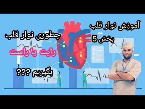 وقتی قلب سمت راست باشه چطورباید نوار بگیریم نوارقلب ۱۲ لیدی