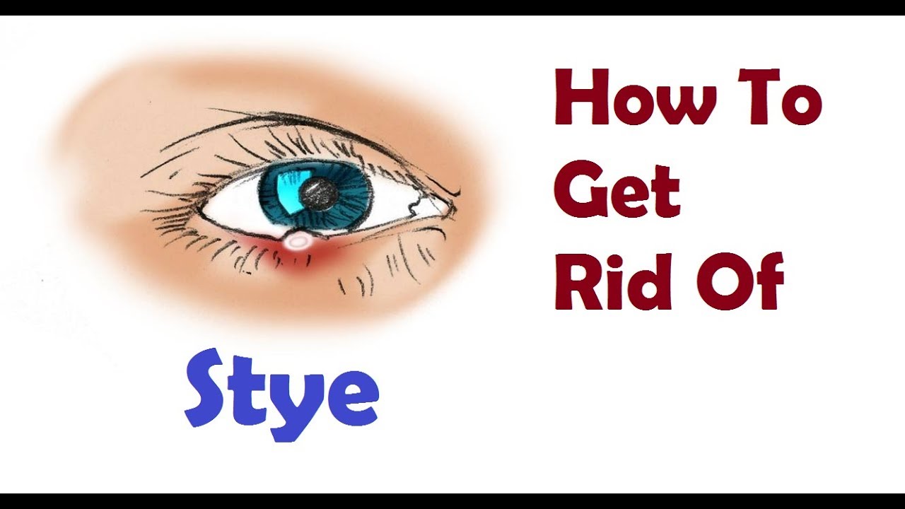blepharitis treatment at home in hindi
