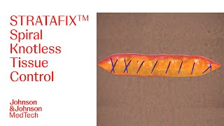 Stratafix Spiral Unidirectional Closure Animation Jj Medtech