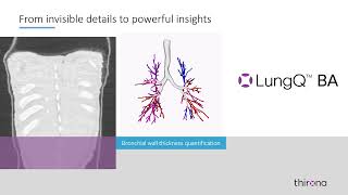 From invisible details to powerful insights - LungQu00ae BA