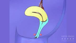 Tampon 3D Visualization