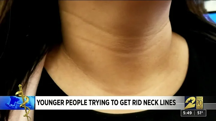 How to get rid of 'tech neck' — creases in your neck that aren't caused by age - DayDayNews