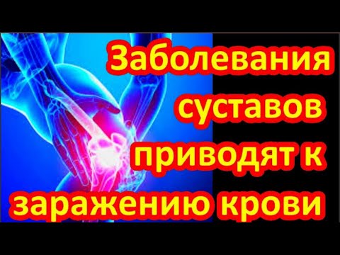 БОЛЬ В КОЛЕНЯХ УШЛА за 2 часа НАРОДНОЕ средство от АРТРОЗА #здоровье