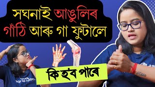 বাৰে বাৰে আঙুলিৰ গাঁঠি আৰু গা ফুটালে কি হ'ব পাৰে || Joint Cracking || Ponkhi Sharma by Healthy Life By Ponnkhi Sharrma 8,058 views 1 month ago 11 minutes, 59 seconds