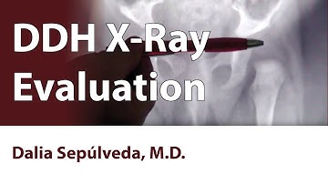 DDH X-Ray Evaluation