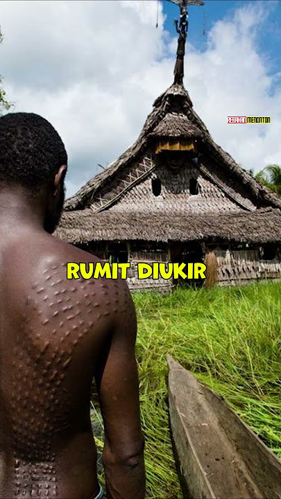 TERNYATA TANDA BINTIK BINTIK DI TUBUH KILLMONGER PUNYA MAKNA MENDALAM DALAM KEHIDUPAN NYATA - MCU