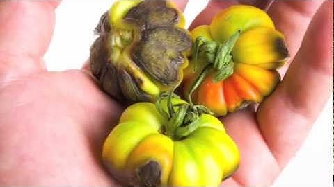 Malnutrition and Global Hunger