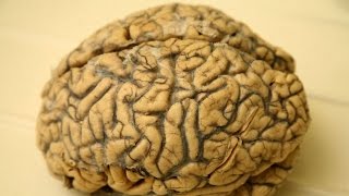 Connaissez-vous la 'brain gym' ou gym du cerveau ?