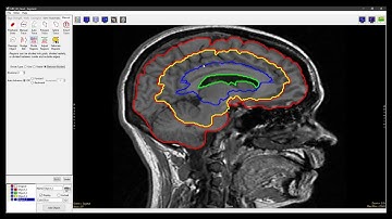 Analyze 15.0 - Segment: Divide Regions Between Borders