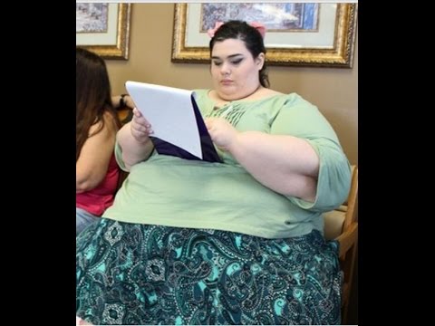 Mulher super obesa se supera/ antes e depois da cirurgia bariátrica emagrecimento obesidade mórbida